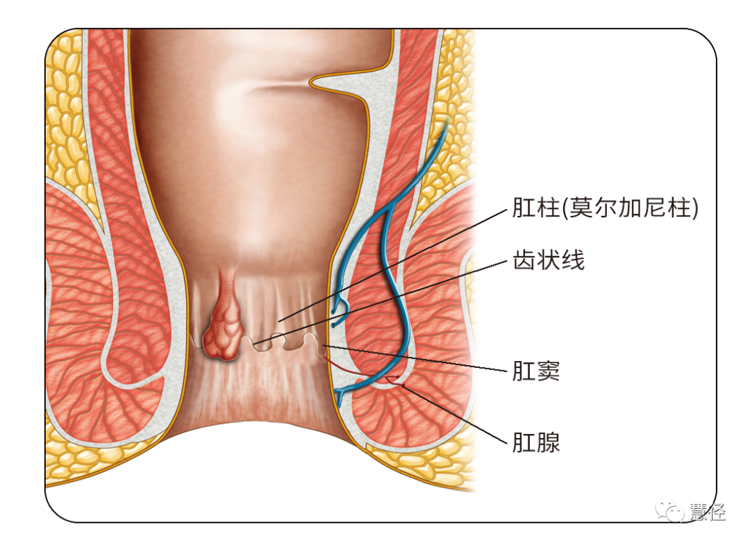 软牙位于直肠末端齿状线区,是由于直肠管径在接近肛管时骤然缩小