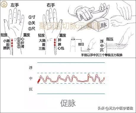 正确的把脉姿势图片